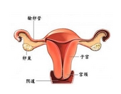 什么原因引起多囊卵巢症