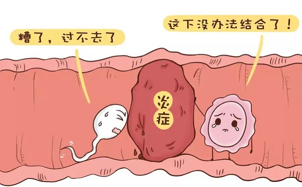 重庆输卵管通而不畅怎么回事？
